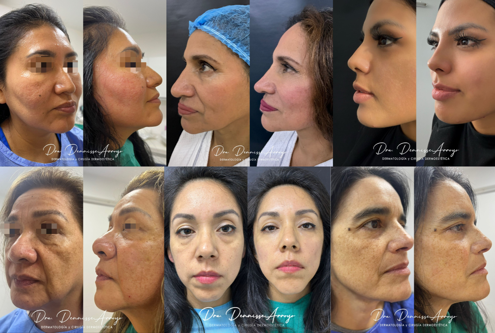 Casos de éxito - Transformaciones reales